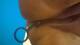 Anal