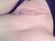 vagina bollente